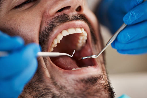 Best Emergency Tooth Extraction  in Panama City, FL